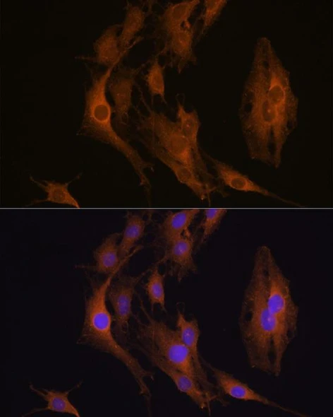 Anti-EIF2AK3 Antibody (CAB18196)