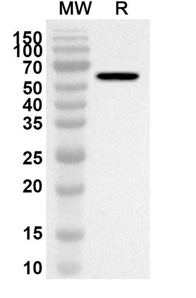 Anti-Ramucirumab Polyclonal Antibody