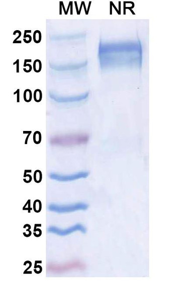 Anti-Dupilumab Neutralizing Antibody [SAA2183]