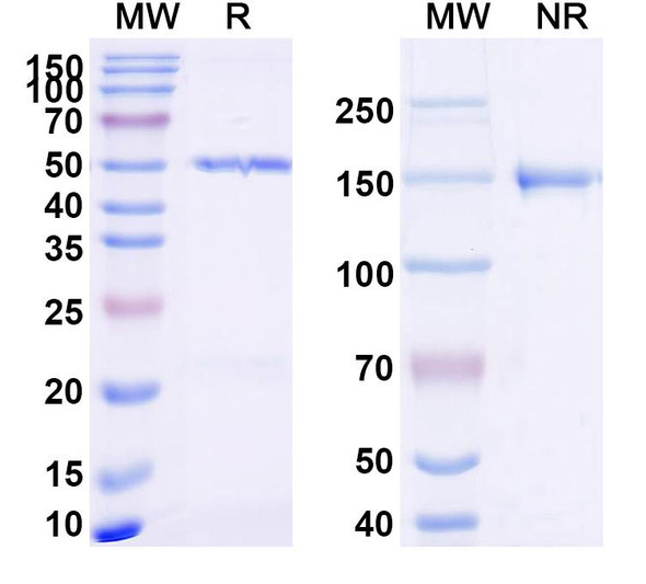 Anti-Dupilumab Non-Neutralizing Antibody [SAA2184]