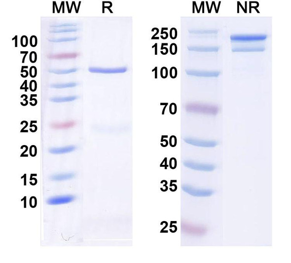 Anti-Siltuximab Neutralizing Antibody [1A456]