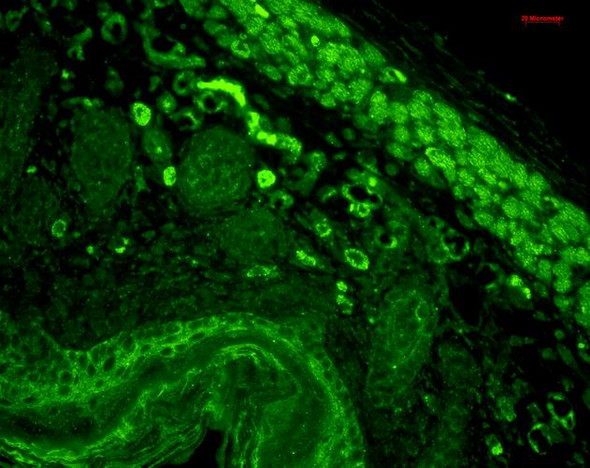 Immunohistochemistry analysis using Mouse Anti-CD74 Monoclonal Antibody, Clone PIN 1.1 (STMA00011). Tissue: backskin. Species: Mouse. Fixation: Bouin's Fixative and paraffin-embedded. Primary Antibody: Mouse Anti-CD74 Monoclonal Antibody (STMA00011) at 1:100 for 1 hour at RT. Secondary Antibody: FITC Goat Anti-Mouse (green) at 1:50 for 1 hour at RT.