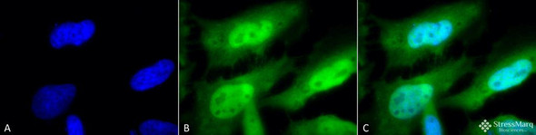 Immunocytochemistry/Immunofluorescence analysis using Rat Anti-HSF1 Monoclonal Antibody, Clone 10H8 (STMA00012). Tissue: Heat Shocked cervical cancer cells (HeLa). Species: Human. Fixation: 2% Formaldehyde for 20 min at RT. Primary Antibody: Rat Anti-HSF1 Monoclonal Antibody (STMA00012) at 1:100 for 12 hours at 4°C. Secondary Antibody: FITC Goat Anti-Rat (green) at 1:200 for 2 hours at RT.