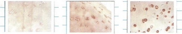 Immunocytochemistry/Immunofluorescence analysis using Mouse Anti-SOD3 Monoclonal Antibody, Clone 4GG11G6 (STMA00041). Tissue: cartilage. Species: Human. Primary Antibody: Mouse Anti-SOD3 Monoclonal Antibody (STMA00041) at 1:1000. Left: control, middle: young cartilage, right: cartilage with osteoarthritis.