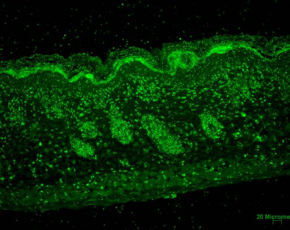 Immunohistochemistry analysis using Mouse Anti-Erp57 Monoclonal Antibody, Clone Map.ERP57 (STMA00042). Tissue: backskin. Species: Mouse. Fixation: Bouin's Fixative and paraffin-embedded. Primary Antibody: Mouse Anti-Erp57 Monoclonal Antibody (STMA00042) at 1:100 for 1 hour at RT. Secondary Antibody: FITC Goat Anti-Mouse (green) at 1:50 for 1 hour at RT. Localization: Epidermis and Hair Follicles.