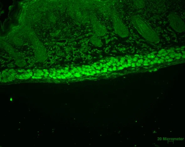 Immunohistochemistry analysis using Rat Anti-Aha1 Monoclonal Antibody, Clone 25F2.D9 (STMA00044). Tissue: backskin. Species: Mouse. Fixation: Bouin's Fixative and paraffin-embedded. Primary Antibody: Rat Anti-Aha1 Monoclonal Antibody (STMA00044) at 1:100 for 1 hour at RT. Secondary Antibody: FITC Goat Anti-Rat (green) at 1:50 for 1 hour at RT. Localization: Uppermost epidermis staining, and muscle.