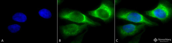 Immunocytochemistry/Immunofluorescence analysis using Mouse Anti-Hsp47 Monoclonal Antibody, Clone 1C4-1A6 (STMA00058). Tissue: Heat Shocked cervical cancer cells (HeLa). Species: Human. Fixation: 2% Formaldehyde for 20 min at RT. Primary Antibody: Mouse Anti-Hsp47 Monoclonal Antibody (STMA00058) at 1:100 for 12 hours at 4°C. Secondary Antibody: FITC Goat Anti-Mouse (green) at 1:200 for 2 hours at RT.