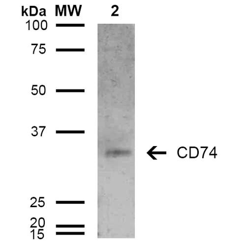 Western Blot analysis of Human Lymphoblastoid cell line (Raji) showing detection of 33-35 kDa CD74 protein using Mouse Anti-CD74 Monoclonal Antibody, Clone 6D9 (STMA00079). Lane 1: Molecular Weight Ladder (MW). Lane 2: Raji cell lysate. Load: 15 µg. Block: 5% Skim Milk in TBST. Primary Antibody: Mouse Anti-CD74 Monoclonal Antibody (STMA00079) at 1:1000 for 2 hours at RT. Secondary Antibody: Goat Anti-Mouse IgG: HRP at 1:1000 for 60 min at RT.