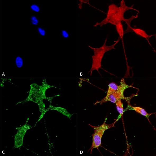 Immunocytochemistry/Immunofluorescence analysis using Mouse Anti-Cav3.2 Monoclonal Antibody, Clone N55/10 (STMA00082). Tissue: Neuroblastoma cells (SH-SY5Y). Species: Human. Fixation: 4% PFA for 15 min. Primary Antibody: Mouse Anti-Cav3.2 Monoclonal Antibody (STMA00082) at 1:50 for overnight at 4°C with slow rocking. Secondary Antibody: AlexaFluor 488 at 1:1000 for 1 hour at RT.