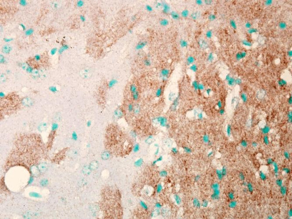 Immunohistochemistry analysis using Mouse Anti-Nav1.7 Sodium Channel Monoclonal Antibody, Clone N68/6 (STMA00088). Tissue: Brain Slice. Species: Mouse. Fixation: Frozen sections. Primary Antibody: Mouse Anti-Nav1.7 Sodium Channel Monoclonal Antibody (STMA00088) at 1:1000. Secondary Antibody: HRP/DAB Detection System: Biotinylated Goat Anti-Mouse, Streptavidin Peroxidase, DAB Chromogen (brown).
