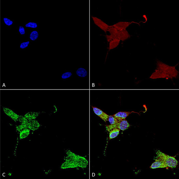 Immunocytochemistry/Immunofluorescence analysis using Mouse Anti-TrpM7 Monoclonal Antibody, Clone S74 (STMA00089). Tissue: Neuroblastoma cells (SH-SY5Y). Species: Human. Fixation: 4% PFA for 15 min. Primary Antibody: Mouse Anti-TrpM7 Monoclonal Antibody (STMA00089) at 1:50 for overnight at 4°C with slow rocking. Secondary Antibody: AlexaFluor 488 at 1:1000 for 1 hour at RT.