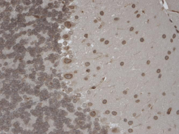Immunohistochemistry analysis using Mouse Anti-TrpM7 Monoclonal Antibody, Clone S74 (STMA00089). Tissue: Brain Slice. Species: Mouse. Fixation: 10% Formalin Solution for 12-24 hours at RT. Primary Antibody: Mouse Anti-TrpM7 Monoclonal Antibody (STMA00089) at 1:1000 for 1 hour at RT. Secondary Antibody: HRP/DAB Detection System: Biotinylated Goat Anti-Mouse, Streptavidin Peroxidase, DAB Chromogen (brown) for 30 minutes at RT.