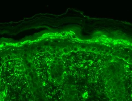 Immunohistochemistry analysis using Mouse Anti-TrpV3 Monoclonal Antibody, Clone S15-39 (STMA00096). Tissue: backskin. Species: Mouse. Fixation: Bouin's Fixative and paraffin-embedded. Primary Antibody: Mouse Anti-TrpV3 Monoclonal Antibody (STMA00096) at 1:100 for 1 hour at RT. Secondary Antibody: FITC Goat Anti-Mouse (green) at 1:50 for 1 hour at RT. Localization: Filaggrin-like staining in upper layers. Dull lower layer cell staining.