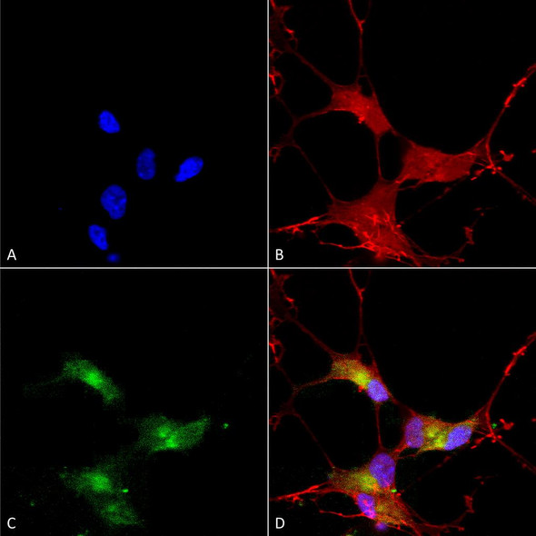 Immunocytochemistry/Immunofluorescence analysis using Mouse Anti-SHANK3 Monoclonal Antibody, Clone S69-46 (STMA00097). Tissue: Neuroblastoma cells (SH-SY5Y). Species: Human. Fixation: 4% PFA for 15 min. Primary Antibody: Mouse Anti-SHANK3 Monoclonal Antibody (STMA00097) at 1:50 for overnight at 4°C with slow rocking. Secondary Antibody: AlexaFluor 488 at 1:1000 for 1 hour at RT.
