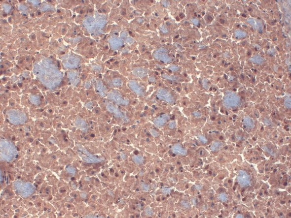 Immunohistochemistry analysis using Mouse Anti-GABA A Receptor Monoclonal Antibody, Clone N87/25 (STMA00099). Tissue: Brain. Species: mouse. Fixation: 10% Formalin Solution for 12-24 hours at RT. Primary Antibody: Mouse Anti-GABA A Receptor Monoclonal Antibody (STMA00099) at 1:1000 for 1 hour at RT. Secondary Antibody: HRP/DAB Detection System: Biotinylated Goat Anti-Mouse, Streptavidin Peroxidase, DAB Chromogen (brown) for 30 minutes at RT.