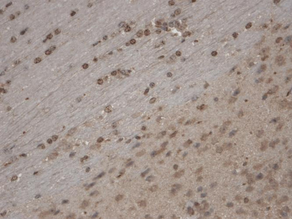 Immunohistochemistry analysis using Mouse Anti-TrpC5 Monoclonal Antibody, Clone N67/15 (STMA00102). Tissue: Brain Slice. Species: Mouse. Fixation: 10% Formalin Solution for 12-24 hours at RT. Primary Antibody: Mouse Anti-TrpC5 Monoclonal Antibody (STMA00102) at 1:1000 for 1 hour at RT. Secondary Antibody: HRP/DAB Detection System: Biotinylated Goat Anti-Mouse, Streptavidin Peroxidase, DAB Chromogen (brown) for 30 minutes at RT.