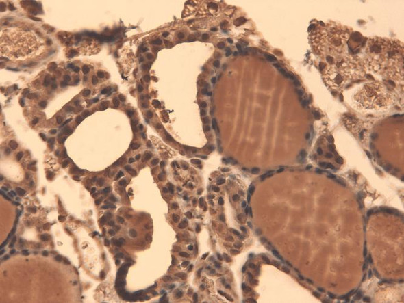 Immunohistochemistry analysis using Mouse Anti-Sodium Iodide Symporter Monoclonal Antibody, Clone 14F (STMA00106). Tissue: Thyroid. Species: Mouse. Fixation: 10% Formalin Solution for 12-24 hours at RT. Primary Antibody: Mouse Anti-Sodium Iodide Symporter Monoclonal Antibody (STMA00106) at 1:1000 for 1 hour at RT.