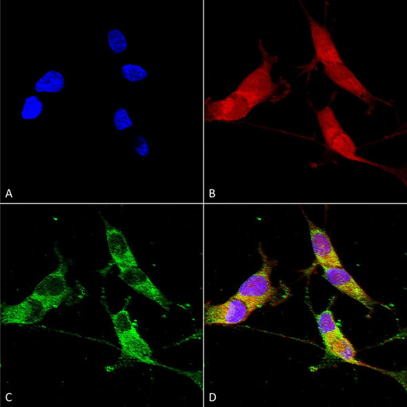 Immunocytochemistry/Immunofluorescence analysis using Mouse Anti-VGLUT2 Monoclonal Antibody, Clone N29/29 (STMA00110). Tissue: Neuroblastoma cells (SH-SY5Y). Species: Human. Fixation: 4% PFA for 15 min. Primary Antibody: Mouse Anti-VGLUT2 Monoclonal Antibody (STMA00110) at 1:50 for overnight at 4°C with slow rocking. Secondary Antibody: AlexaFluor 488 at 1:1000 for 1 hour at RT.