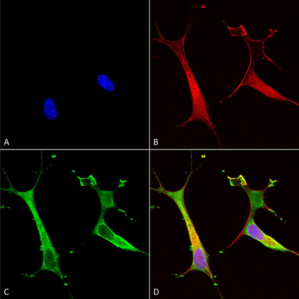 Immunocytochemistry/Immunofluorescence analysis using Mouse Anti-Copper Transporting ATPase 2 Monoclonal Antibody, Clone L62/29 (STMA00114). Tissue: Neuroblastoma cells (SH-SY5Y). Species: Human. Fixation: 4% PFA for 15 min. Primary Antibody: Mouse Anti-Copper Transporting ATPase 2 Monoclonal Antibody (STMA00114) at 1:100 for overnight at 4°C with slow rocking. Secondary Antibody: AlexaFluor 488 at 1:1000 for 1 hour at RT.