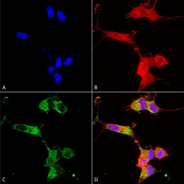 Immunocytochemistry/Immunofluorescence analysis using Mouse Anti-NALCN Monoclonal Antibody, Clone N187/7 (STMA00127). Tissue: Neuroblastoma cells (SH-SY5Y). Species: Human. Fixation: 4% PFA for 15 min. Primary Antibody: Mouse Anti-NALCN Monoclonal Antibody (STMA00127) at 1:100 for overnight at 4°C with slow rocking. Secondary Antibody: AlexaFluor 488 at 1:1000 for 1 hour at RT.