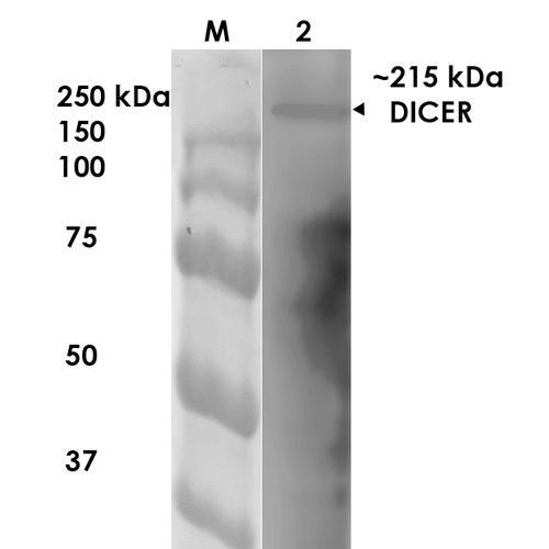 Western Blot analysis of Rat Brain Membrane showing detection of ~215 kDa Dicer protein using Mouse Anti-Dicer Monoclonal Antibody, Clone N167/7 (STMA00126). Lane 1: MW Ladder. Lane 2: Rat Brain Membrane. Load: 10 µg. Block: 5% milk. Primary Antibody: Mouse Anti-Dicer Monoclonal Antibody (STMA00126) at 1:1000 for 1 hour at RT. Secondary Antibody: Goat Anti-Mouse IgG: HRP at 1:200 for 1 hour at RT.