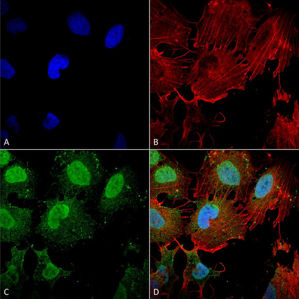 Immunocytochemistry/Immunofluorescence analysis using Mouse Anti-mGluR1/5 glutamate receptor Monoclonal Antibody, Clone N75/3 (STMA00129). Tissue: Neuroblastoma cell line (SK-N-BE). Species: Human. Fixation: 4% Formaldehyde for 15 min at RT. Primary Antibody: Mouse Anti-mGluR1/5 glutamate receptor Monoclonal Antibody (STMA00129) at 1:100 for 60 min at RT. Secondary Antibody: Goat Anti-Mouse ATTO 488 at 1:200 for 60 min at RT.