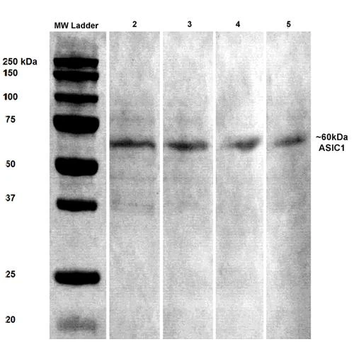 Western Blot analysis of Rat brain lysates showing detection of ASIC1 protein using Mouse Anti-ASIC1 Monoclonal Antibody, Clone N271/44 (STMA00132). Primary Antibody: Mouse Anti-ASIC1 Monoclonal Antibody (STMA00132) at 1:100, 1:250, 1:500, and 1:1000.