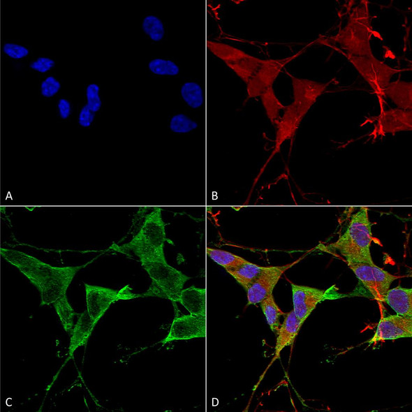 Immunocytochemistry/Immunofluorescence analysis using Mouse Anti-LAR/PTPRF Monoclonal Antibody, Clone N165/38 (STMA00143). Tissue: Neuroblastoma cells (SH-SY5Y). Species: Human. Fixation: 4% PFA for 15 min. Primary Antibody: Mouse Anti-LAR/PTPRF Monoclonal Antibody (STMA00143) at 1:100 for overnight at 4°C with slow rocking. Secondary Antibody: AlexaFluor 488 at 1:1000 for 1 hour at RT.