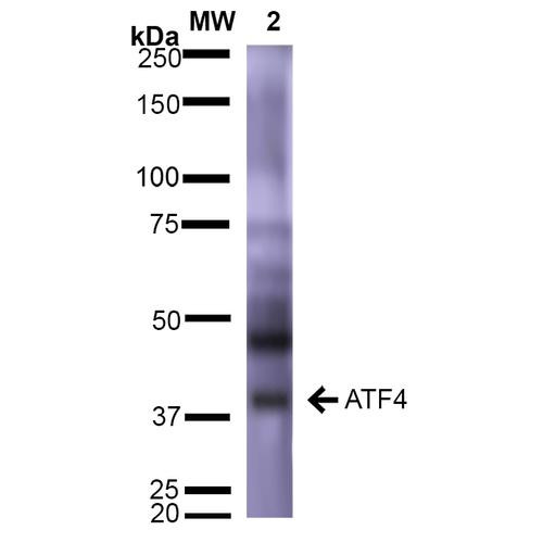 Western Blot analysis of Rat Brain showing detection of ~39 kDa (isoform 2) ATF4 protein using Mouse Anti-ATF4 Monoclonal Antibody, Clone N360A/24 (STMA00146). Lane 1: Molecular Weight Ladder (MW). Lane 2: Rat Brain. Load: 15 µg. Block: 5% Skim Milk in 1X TBST. Primary Antibody: Mouse Anti-ATF4 Monoclonal Antibody (STMA00146) at 1:1000 for 2 hours at RT. Secondary Antibody: Goat Anti-Mouse IgG: HRP at 1:2000 for 60 min at RT.