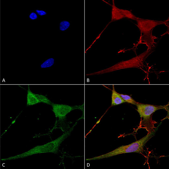 Immunocytochemistry/Immunofluorescence analysis using Mouse Anti-NrCAM Monoclonal Antibody, Clone N364/51 (STMA00155). Tissue: Neuroblastoma cells (SH-SY5Y). Species: Human. Fixation: 4% PFA for 15 min. Primary Antibody: Mouse Anti-NrCAM Monoclonal Antibody (STMA00155) at 1:100 for overnight at 4°C with slow rocking. Secondary Antibody: AlexaFluor 488 at 1:1000 for 1 hour at RT.