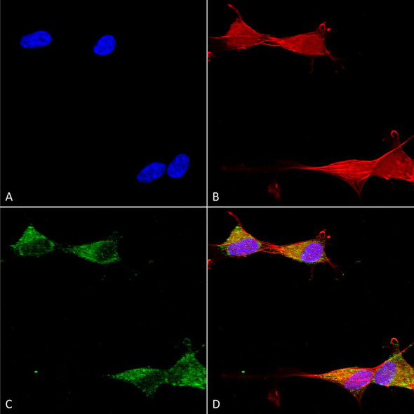 Immunocytochemistry/Immunofluorescence analysis using Mouse Anti-Ataxin 1 Monoclonal Antibody, Clone N65/37 (STMA00161). Tissue: Neuroblastoma cells (SH-SY5Y). Species: Human. Fixation: 4% PFA for 15 min. Primary Antibody: Mouse Anti-Ataxin 1 Monoclonal Antibody (STMA00161) at 1:50 for overnight at 4°C with slow rocking. Secondary Antibody: AlexaFluor 488 at 1:1000 for 1 hour at RT.