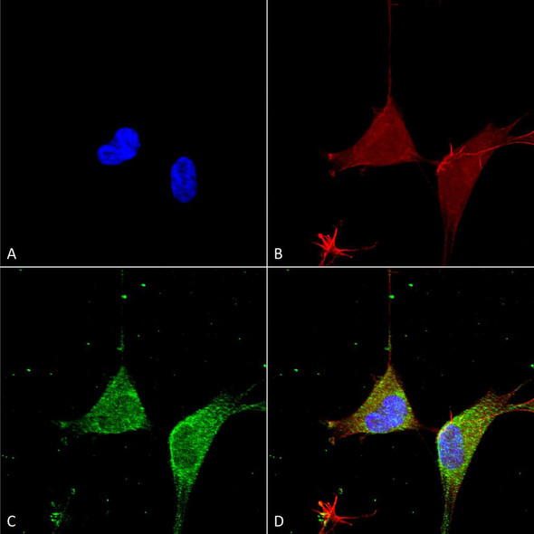 Immunocytochemistry/Immunofluorescence analysis using Mouse Anti-GABA A Receptor Alpha 5 Monoclonal Antibody, Clone N415/24 (STMA00171). Tissue: Neuroblastoma cells (SH-SY5Y). Species: Human. Fixation: 4% PFA for 15 min. Primary Antibody: Mouse Anti-GABA A Receptor Alpha 5 Monoclonal Antibody (STMA00171) at 1:50 for overnight at 4°C with slow rocking. Secondary Antibody: AlexaFluor 488 at 1:1000 for 1 hour at RT.