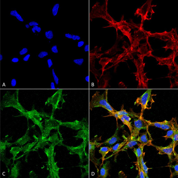 Immunocytochemistry/Immunofluorescence analysis using Mouse Anti-Citrulline Monoclonal Antibody, Clone 2D3.1 (STMA00173). Tissue: Embryonic kidney epithelial cell line (HEK293). Species: Human. Fixation: 5% Formaldehyde for 5 min. Primary Antibody: Mouse Anti-Citrulline Monoclonal Antibody (STMA00173) at 1:50 for 30-60 min at RT. Secondary Antibody: Goat Anti-Mouse Alexa Fluor 488 at 1:1500 for 30-60 min at RT.