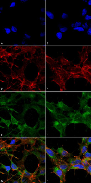 Immunocytochemistry/Immunofluorescence analysis using Mouse Anti-Acrolein Monoclonal Antibody, Clone 10A10 (STMA00178). Tissue: Embryonic kidney epithelial cell line (HEK293). Species: Human. Fixation: 5% Formaldehyde for 5 min. Primary Antibody: Mouse Anti-Acrolein Monoclonal Antibody (STMA00178) at 1:50 for 30-60 min at RT. Secondary Antibody: Goat Anti-Mouse Alexa Fluor 488 at 1:1500 for 30-60 min at RT.