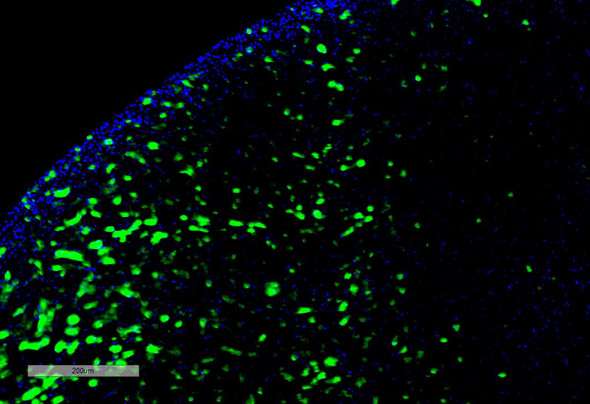 Immunohistochemistry analysis using Mouse Anti-Hexanoyl-Lysine adduct Monoclonal Antibody, Clone 5D9 (STMA00179). Tissue: Kidney. Species: Rat. Primary Antibody: Mouse Anti-Hexanoyl-Lysine adduct Monoclonal Antibody (STMA00179) at 1:100 for Overnight at 4C, then 30 min at 37C. Secondary Antibody: Goat Anti-Mouse IgG (H+L): FITC for 45 min at 37C. Counterstain: DAPI for 3 min at RT. Magnification: 10X.