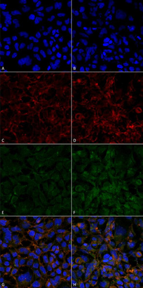 Immunocytochemistry/Immunofluorescence analysis using Mouse Anti-Hexanoyl-Lysine adduct Monoclonal Antibody, Clone 5E8 (STMA00180). Tissue: Embryonic kidney epithelial cell line (HEK293). Species: Human. Fixation: 5% Formaldehyde for 5 min. Primary Antibody: Mouse Anti-Hexanoyl-Lysine adduct Monoclonal Antibody (STMA00180) at 1:50 for 30-60 min at RT. Secondary Antibody: Goat Anti-Mouse Alexa Fluor 488 at 1:1500 for 30-60 min at RT.