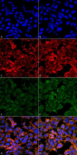 Immunocytochemistry/Immunofluorescence analysis using Mouse Anti-Malondialdehyde Monoclonal Antibody, Clone 11E3 (STMA00185). Tissue: Embryonic kidney epithelial cell line (HEK293). Species: Human. Fixation: 5% Formaldehyde for 5 min. Primary Antibody: Mouse Anti-Malondialdehyde Monoclonal Antibody (STMA00185) at 1:50 for 30-60 min at RT. Secondary Antibody: Goat Anti-Mouse Alexa Fluor 488 at 1:1500 for 30-60 min at RT.