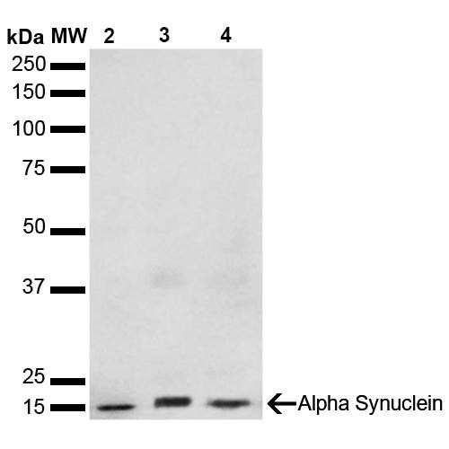 Western Blot analysis of Human, Mouse, Rat Brain showing detection of 14 kDa Alpha Synuclein protein using Mouse Anti-Alpha Synuclein Monoclonal Antibody, Clone 3F8 (STMA00193). Lane 1: Molecular Weight Ladder (MW). Lane 2: Mouse Brain cell lysate. Lane 3: Rat brain cell lysate. Lane 4: Human brain cell lysate. Load: 15 µg. Block: 5% Skim Milk in 1X TBST.