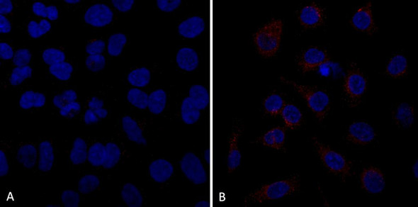 Immunocytochemistry/Immunofluorescence analysis using Mouse Anti-VPS35 Monoclonal Antibody, Clone 10A8 (STMA00211). Tissue: A549 cells. Species: Human. Primary Antibody: Mouse Anti-VPS35 Monoclonal Antibody (STMA00211) at 1:5 (tissue culture supernatant). Secondary Antibody: Donkey anti-mouse: Alexa Fluor 594 at 1:4000 in 0.2% BSA PBS. Counterstain: DAPI. Localization: Vesicles. A) VPS35 KO A549 cells B) WT A549 cells.