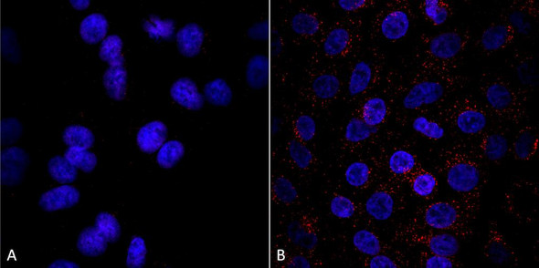 Immunocytochemistry/Immunofluorescence analysis using Mouse Anti-VPS35 Monoclonal Antibody, Clone 8A3 (STMA00210). Tissue: A549 cells. Species: Human. Primary Antibody: Mouse Anti-VPS35 Monoclonal Antibody (STMA00210) at 1:5 (tissue culture supernatant). Secondary Antibody: Donkey anti-mouse: Alexa Fluor 594 at 1:4000 in 0.2% BSA PBS. Counterstain: DAPI. Localization: Vesicles. A) VPS35 KO A549 cells B) WT A549 cells.