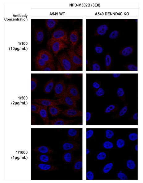 Immunocytochemistry/Immunofluorescence analysis using Mouse Anti-DENND4C Monoclonal Antibody, Clone 3E8 (STMA00216). Tissue: A549 cells. Species: Human. Primary Antibody: Mouse Anti-DENND4C Monoclonal Antibody (STMA00216) at 1:100, 1:500, 1:1000 for 1 hour at RT. Secondary Antibody: Donkey anti-mouse: Alexa Fluor 594 at 1:1000 for 1 hour at RT. Counterstain: DAPI. Courtesy of: Dario Alessi Lab, University of Dundee.