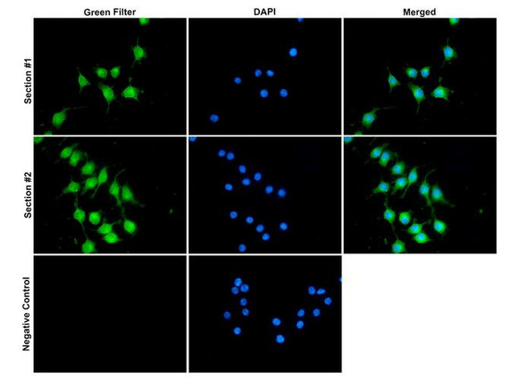 Immunocytochemistry/Immunofluorescence analysis with Rabbit Anti-CASPR2 Monoclonal Antibody, Clone FF19 (STMA00227). Tissue: Pheochromocytoma cells (PC-12). Species: Rat. Fixation: 4% PFA for 10 min at RT. Permeabilization: 0.15% TritonX for 15 min at RT. Blocking: 10% goat serum for 40 min at RT. Primary Antibody: Rabbit Anti-Human CASPR2 Recombinant Monoclonal [FF19] (STMA00227) at 1:100 for 1 hour at RT.