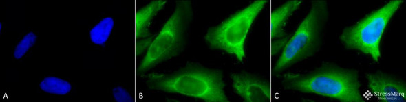 Immunocytochemistry/Immunofluorescence analysis using Rabbit Anti-Hsp40 Polyclonal Antibody (STPA00001). Tissue: Heat Shocked Cervical cancer cell line (HeLa). Species: Human. Fixation: 2% Formaldehyde for 20 min at RT. Primary Antibody: Rabbit Anti-Hsp40 Polyclonal Antibody (STPA00001) at 1:100 for 12 hours at 4°C. Secondary Antibody: FITC Goat Anti-Rabbit (green) at 1:200 for 2 hours at RT.