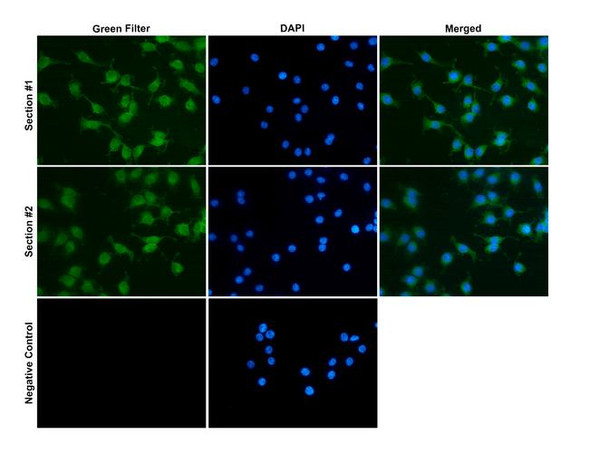 Immunocytochemistry/Immunofluorescence analysis with Rabbit Anti-PSD95 Monoclonal Antibody, Clone B14 (STMA00228). Tissue: Pheochromocytoma cells (PC-12). Species: Rat. Fixation: 4% PFA for 10 min at RT. Permeabilization: 0.15% TritonX for 15 min at RT. Blocking: 10% goat serum for 40 min at RT. Primary Antibody: Rabbit Anti-Human PSD95 Recombinant Monoclonal [B14] (STMA00228) at 1:100 for 1 hour at RT.