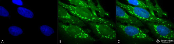 Immunocytochemistry/Immunofluorescence analysis using Rabbit Anti-Hsp60 Polyclonal Antibody (STPA00004). Tissue: Heat Shocked Cervical cancer cell line (HeLa). Species: Human. Fixation: 2% Formaldehyde for 20 min at RT. Primary Antibody: Rabbit Anti-Hsp60 Polyclonal Antibody (STPA00004) at 1:100 for 12 hours at 4°C. Secondary Antibody: FITC Goat Anti-Rabbit (green) at 1:200 for 2 hours at RT.