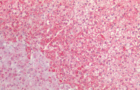 Immunohistochemistry analysis using Rabbit Anti-HSP60 Polyclonal Antibody (STPA00004). Tissue: Adrenal. Species: Human. Fixation: Formalin fixed paraffin-embedded. Primary Antibody: Rabbit Anti-HSP60 Polyclonal Antibody (STPA00004).