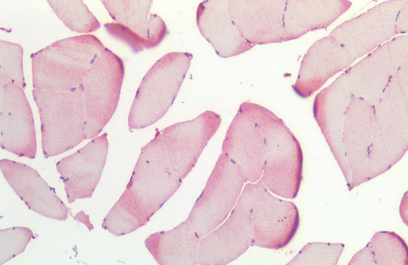 Immunohistochemistry analysis using Rabbit Anti-HSP27 Polyclonal Antibody (STPA00005). Tissue: Skeletal Muscle. Species: Human. Fixation: Formalin fixed paraffin-embedded. Primary Antibody: Rabbit Anti-HSP27 Polyclonal Antibody (STPA00005).
