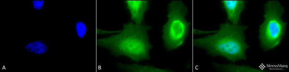 Immunocytochemistry/Immunofluorescence analysis using Rabbit Anti-Calreticulin Polyclonal Antibody (STPA00017). Tissue: Heat Shocked Cervical cancer cell line (HeLa). Species: Human. Fixation: 2% Formaldehyde for 20 min at RT. Primary Antibody: Rabbit Anti-Calreticulin Polyclonal Antibody (STPA00017) at 1:100 for 12 hours at 4°C. Secondary Antibody: FITC Goat Anti-Rabbit (green) at 1:200 for 2 hours at RT.