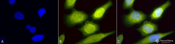 Immunocytochemistry/Immunofluorescence analysis using Rabbit Anti-AHA1 Polyclonal Antibody (STPA00032). Tissue: Heat Shocked Cervical cancer cell line (HeLa). Species: Human. Fixation: 2% Formaldehyde for 20 min at RT. Primary Antibody: Rabbit Anti-AHA1 Polyclonal Antibody (STPA00032) at 1:60 for 12 hours at 4°C. Secondary Antibody: R-PE Goat Anti-Rabbit (yellow) at 1:200 for 2 hours at RT.