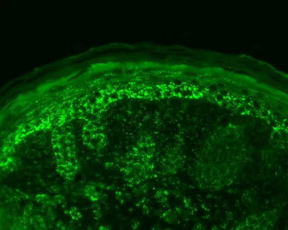 Immunohistochemistry analysis using Rabbit Anti-Cpn10 Polyclonal Antibody (STPA00036). Tissue: backskin. Species: Mouse. Fixation: Bouin's Fixative Solution. Primary Antibody: Rabbit Anti-Cpn10 Polyclonal Antibody (STPA00036) at 1:100 for 1 hour at RT. Secondary Antibody: FITC Goat Anti-Rabbit (green) at 1:50 for 1 hour at RT. Localization: Strong basal layer punctate staining in the cytoplasm, weakens as it ascends to upper epidermis.